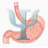 acompanhamento psicológico cirurgia bariátrica Centro